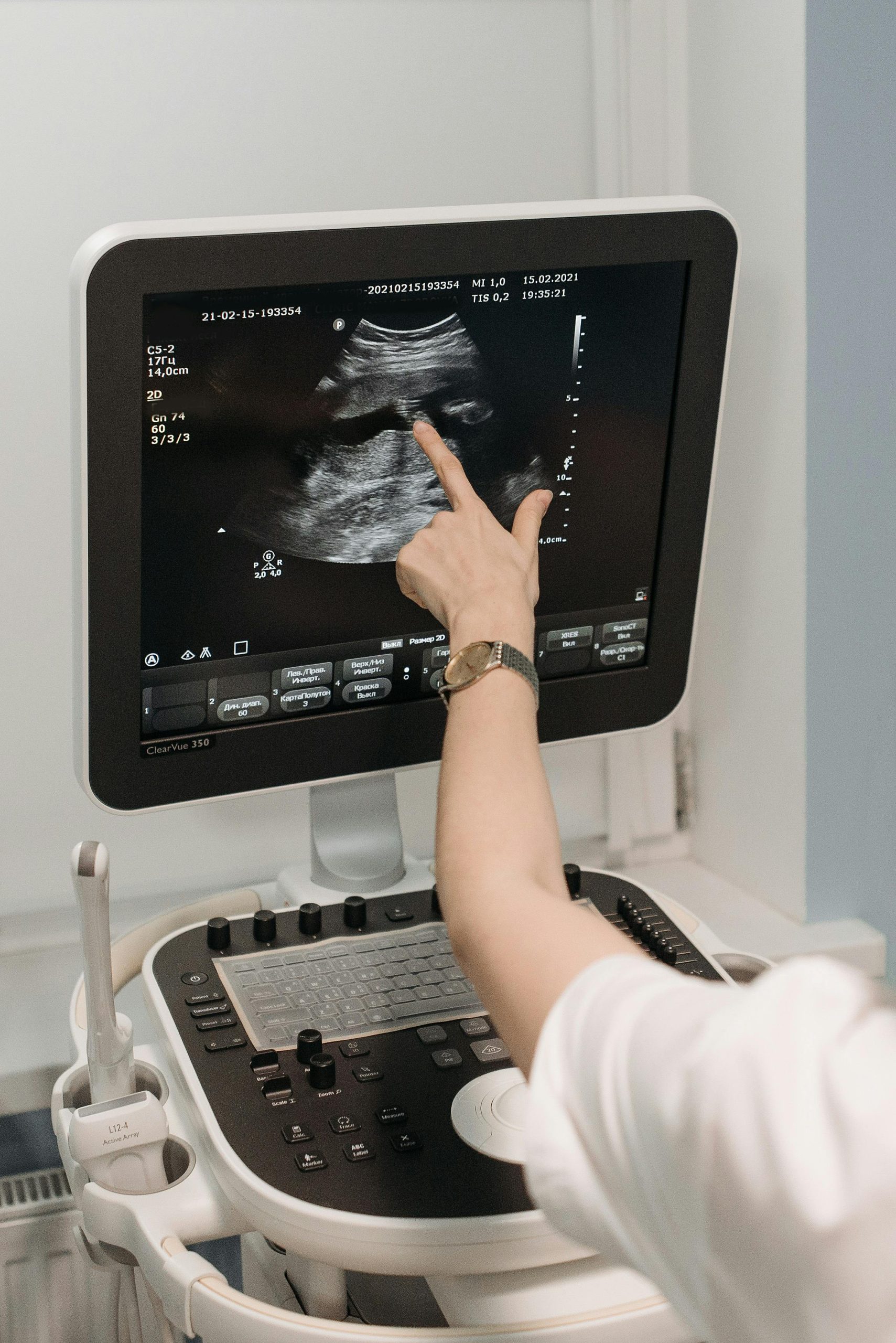 Home 3 Especialidades Médicas Disponíveis Clínico Geral Pediatria Neurologia (Adulto e Pediátrica) Ginecologia Obstetrícia Cardiologia Urologia Dermatologia Pneumologia Psiquiatria Psicologia Fonoaudiologia Traumatologia Ortopédica Clinica Rebelato +10 Wikipédia +10 Blog AmorSaúde +10 Open ClinicOpen Clinic +4 Blog AmorSaúde +4 Wikipédia +4 Open ClinicOpen Clinic +1 🧪 Exames Laboratoriais e Check-ups A clínica oferece mais de mil exames laboratoriais a partir de R$ 5,00, incluindo: Open ClinicOpen Clinic Hemograma completo Glicose e colesterol Raio-X Ultrassonografia (incluindo Doppler) Mamografia Papanicolau Endoscopia Tomografia e ressonância magnética Mapeamento de retina Peeling e retirada de vasos