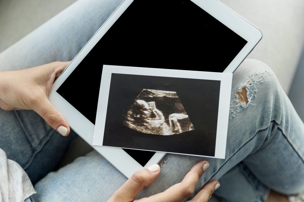 ultrassom-obstetrico-gravatai