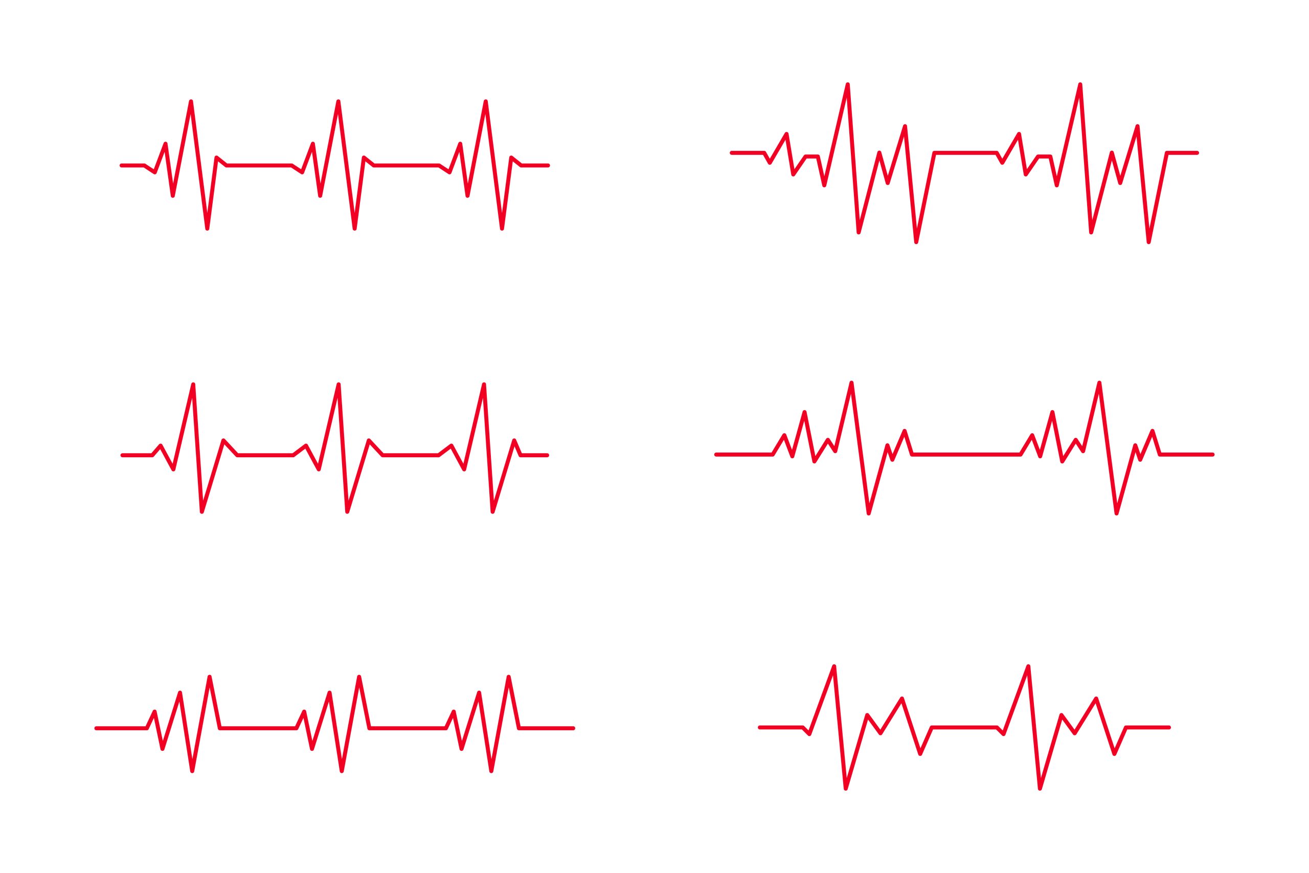 eletrocardiograma
