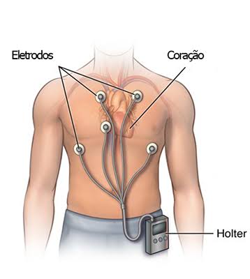 exame coração Holter mapa